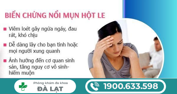 Hình ảnh minh họa